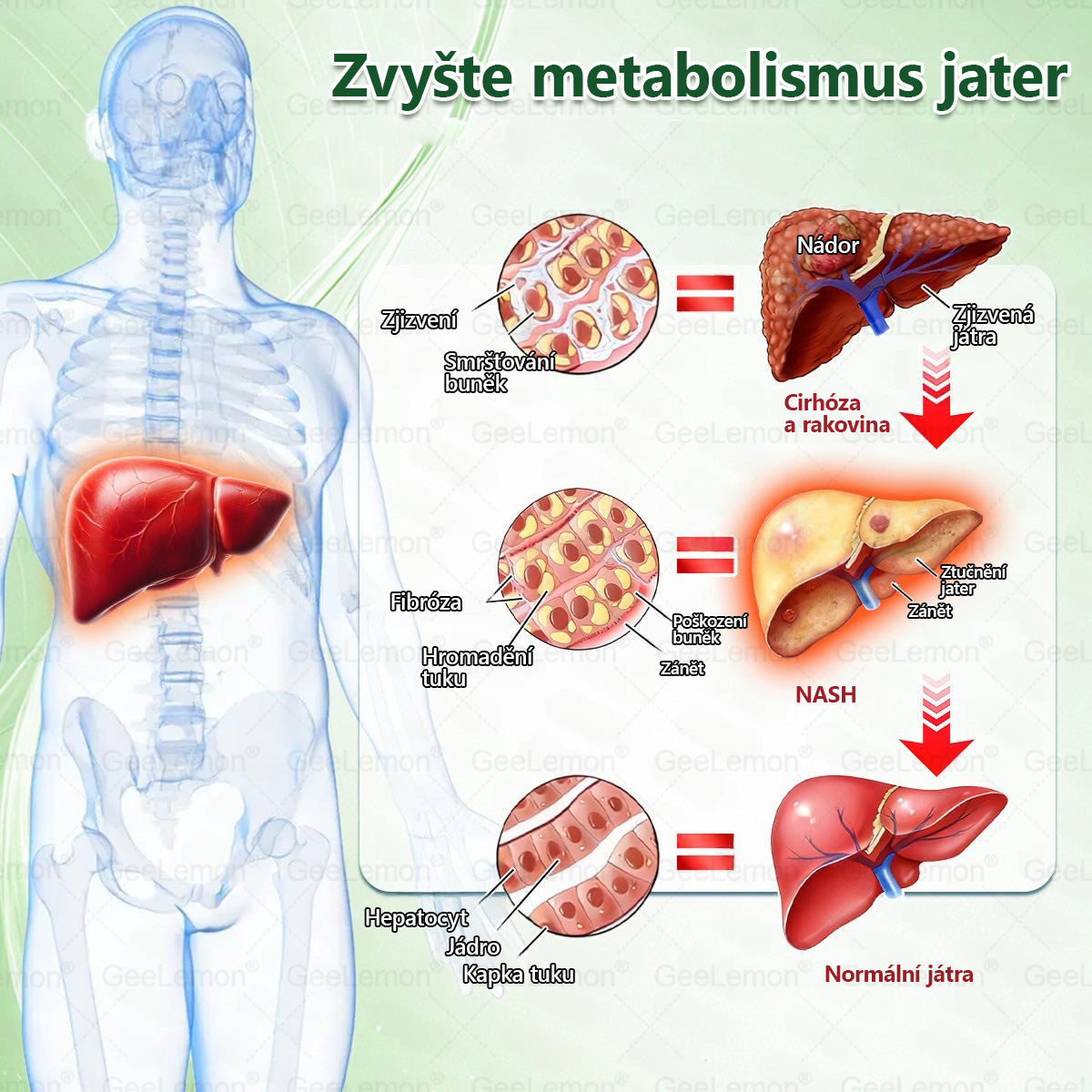 🌿🌿Doporučeno Fakultní nemocnicí Motol ·  Oficiální prodejna BENU | 🎁 𝐆𝐞𝑒𝑙𝑒𝐦𝐨𝐧® Glum𝐚𝐬𝐞tide 8 v 1 – Zeštíhlující nano mikrojihlový náplast 🇨🇿 Jen 1× denně ✅ Viditelné změny za 7 dní – na obezitu, kardiovaskulární zdraví, diabetes a kloubní problémy