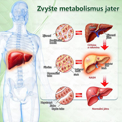 🌿🌿Doporučeno Fakultní nemocnicí Motol ·  Oficiální prodejna BENU | 🎁 𝐆𝐞𝑒𝑙𝑒𝐦𝐨𝐧® Glum𝐚𝐬𝐞tide 8 v 1 – Zeštíhlující nano mikrojihlový náplast 🇨🇿 Jen 1× denně ✅ Viditelné změny za 7 dní – na obezitu, kardiovaskulární zdraví, diabetes a kloubní problémy