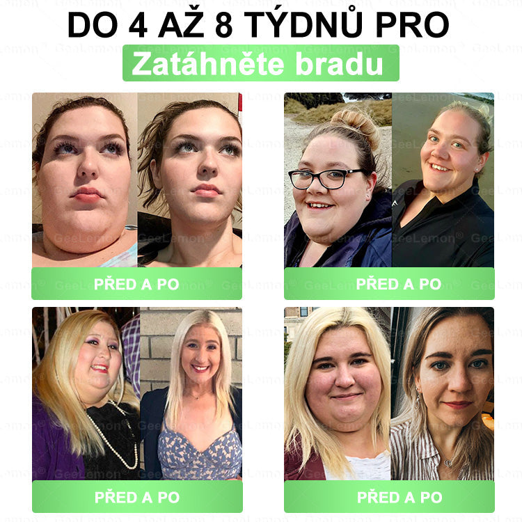 🌿🌿Doporučeno Fakultní nemocnicí Motol ·  Oficiální prodejna BENU | 🎁 𝐆𝐞𝑒𝑙𝑒𝐦𝐨𝐧® Glum𝐚𝐬𝐞tide 8 v 1 – Zeštíhlující nano mikrojihlový náplast 🇨🇿 Jen 1× denně ✅ Viditelné změny za 7 dní – na obezitu, kardiovaskulární zdraví, diabetes a kloubní problémy