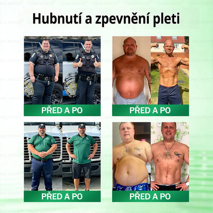 🌿🌿Doporučeno Fakultní nemocnicí Motol ·  Oficiální prodejna BENU | 🎁 𝐆𝐞𝑒𝑙𝑒𝐦𝐨𝐧® Glum𝐚𝐬𝐞tide 8 v 1 – Zeštíhlující nano mikrojihlový náplast 🇨🇿 Jen 1× denně ✅ Viditelné změny za 7 dní – na obezitu, kardiovaskulární zdraví, diabetes a kloubní problémy